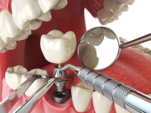 Best Emergency Dental Care for Trauma or Injury in Liberty, MO