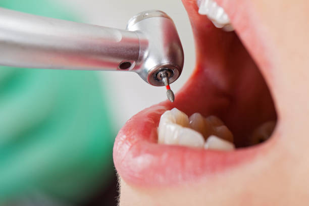 Best Same-Day Emergency Dentist in Liberty, MO